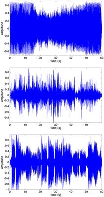 Correspondences Between Music and Involuntary Human Micromotion During Standstill
